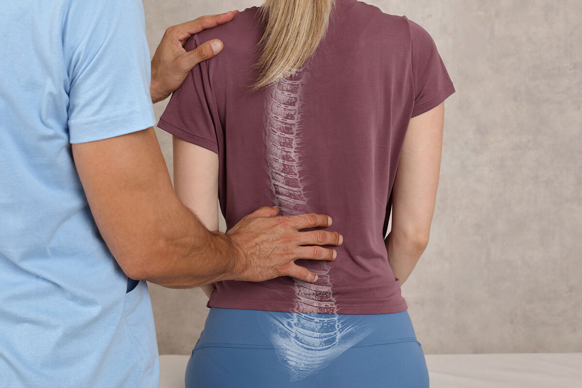 Leistung Skoliose Therapie nach Schroth